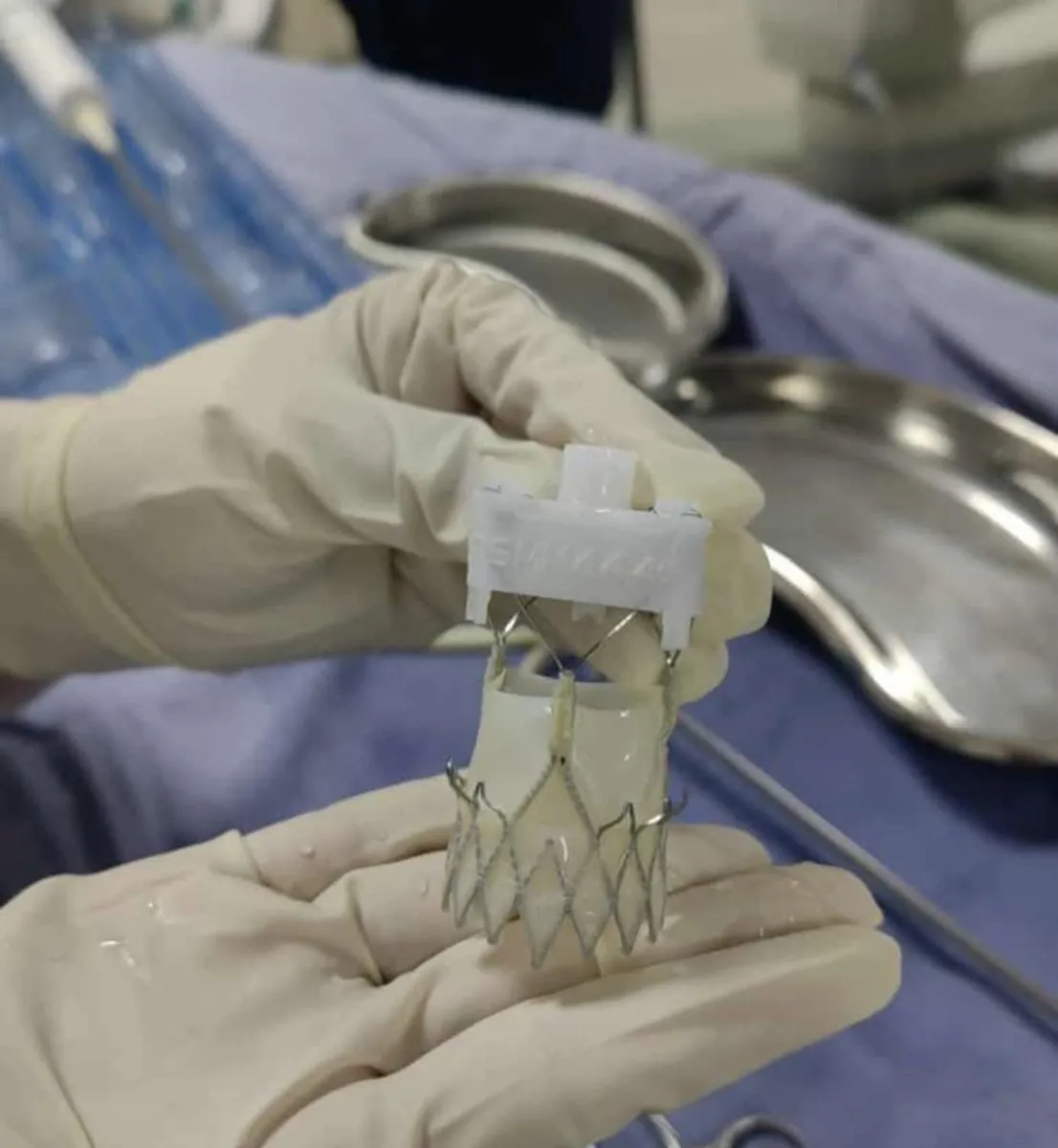 Prótesis valvular para TAVI sostenida por el cardiólogo antes de montarla en el sistema de liberación