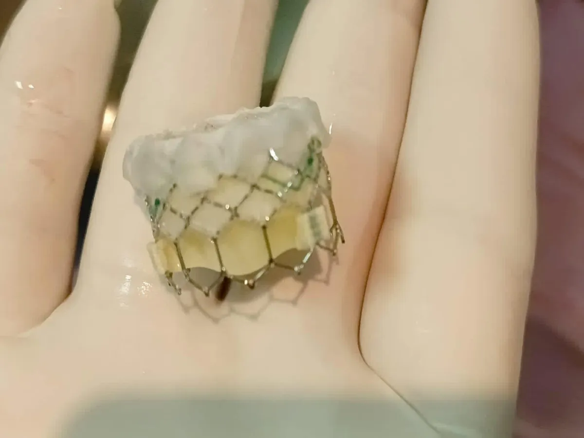 Válvula TAVI autoexpandible con armazón de nitinol sobre la mano del cardiólogo