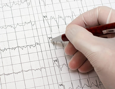 diagnostico-preventivo-cardiologico-en-queretaro.jpg